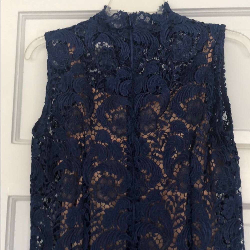 LACE DRESS 💙 - Picture 4 of 6